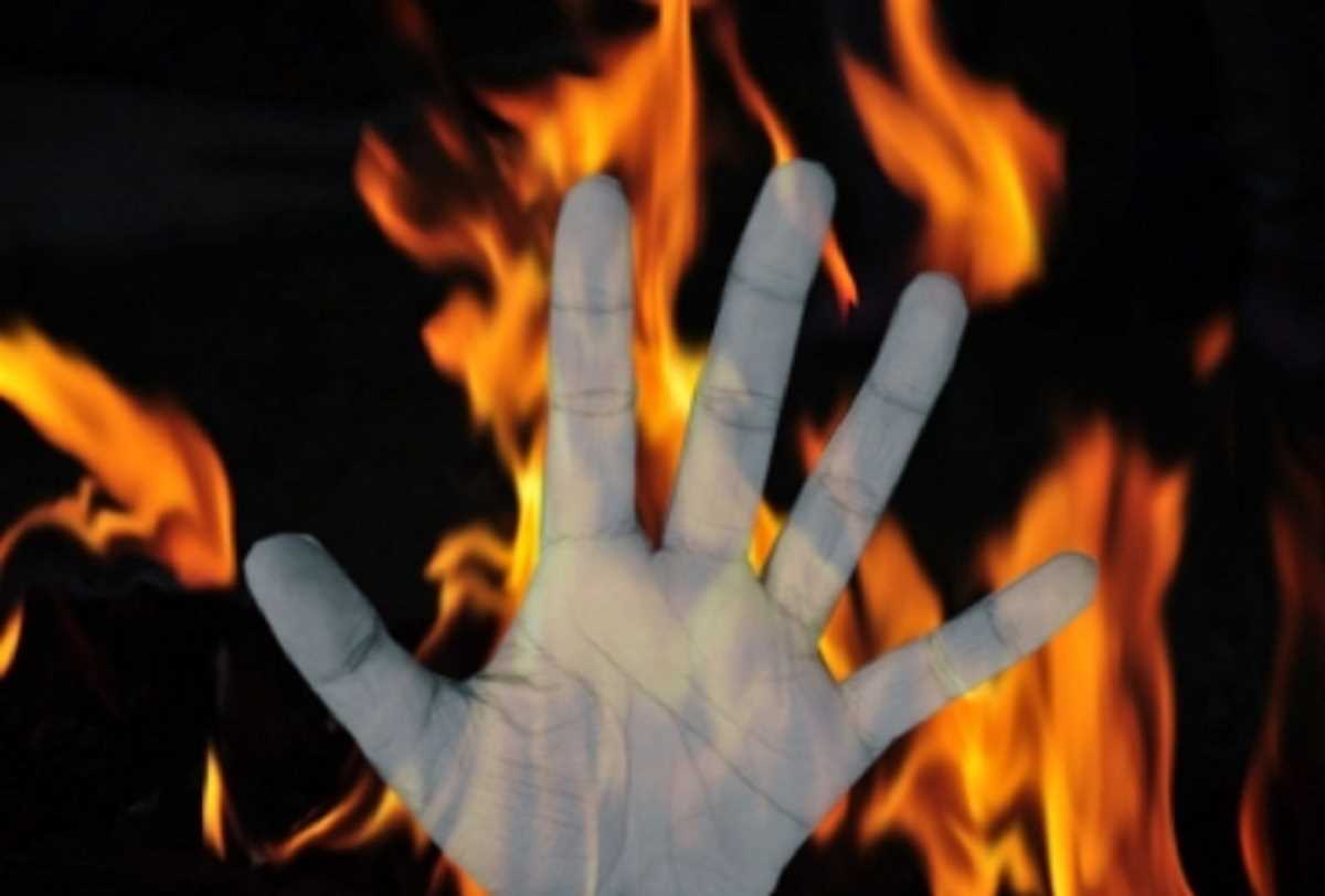 Mau Fire Breaks: झोपड़ी में लगी आग में झुलसकर पांच लोगों की मौत