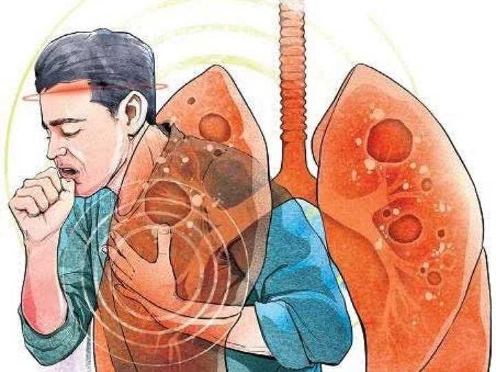 टीबी के खिलाफ कोविड जैसी लड़ाई लड़ सकेगा भारत?