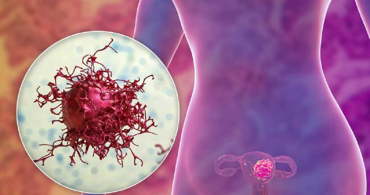 यूटरस ट्रांसप्लांट हो सकता है बांझपन का इलाजः शोध