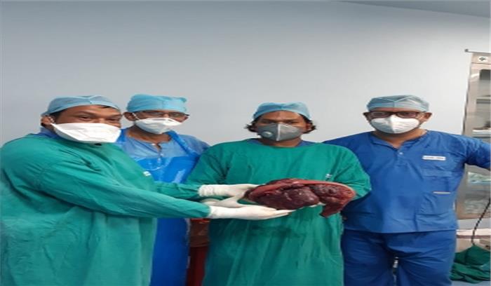 बिहार: लडकी के पेट से निकाला गया 6 किलोग्राम का ट्यूमर, आंत से था चिपका बिहार: लडकी के पेट से निकाला गया 6 किलोग्राम का ट्यूमर, आंत से था चिपका