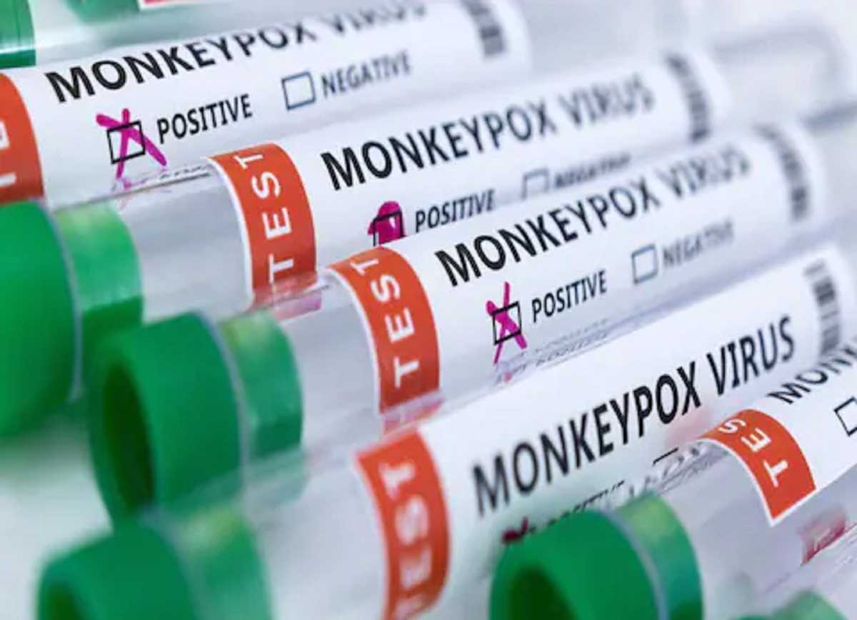 अमेरिका में मंकीपॉक्स से पहली मौत, दुनियाभर में संक्रमण से अब तक 15 की जान गई