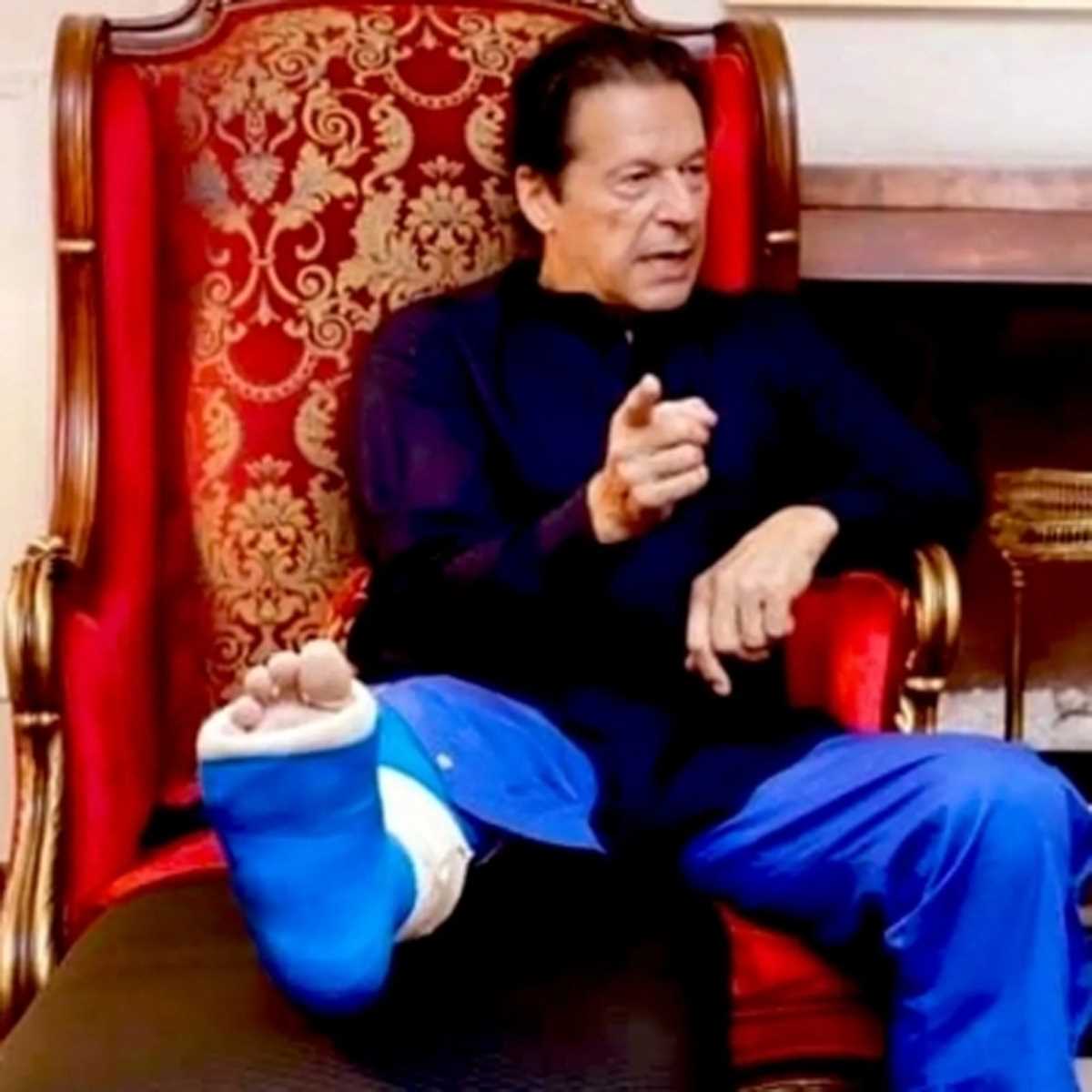 फॉरेंसिक रिपोर्ट में खुलासा- गोली नहीं, बल्कि एक धातु के टुकड़े से हुए थे इमरान घायल