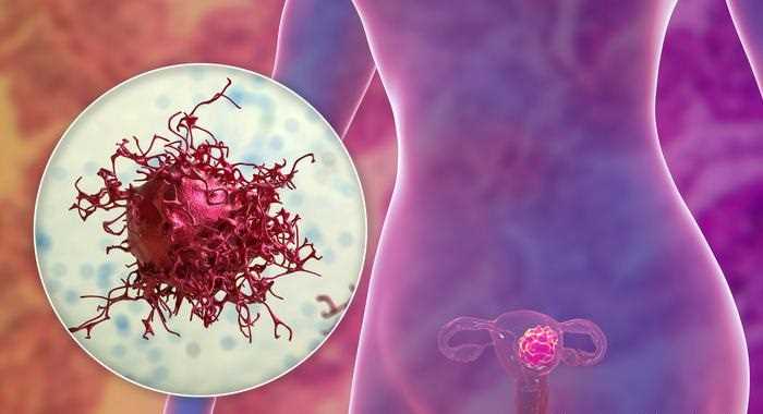 पहली बारः खत्म हो गया परीक्षण में शामिल सारे मरीजों का कैंसर पहली बारः खत्म हो गया परीक्षण में शामिल सारे मरीजों का कैंसर