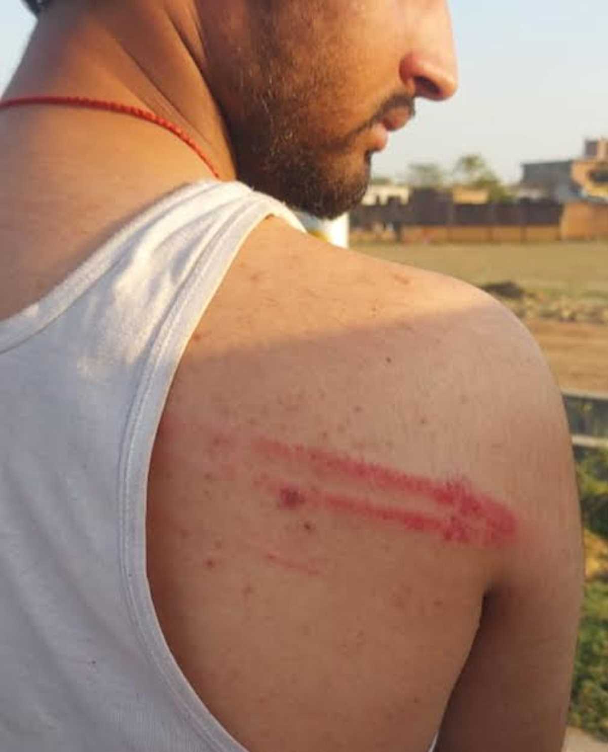 बाजार से लौट रहे युवक के साथ मारपीट बाजार से लौट रहे युवक के साथ मारपीट