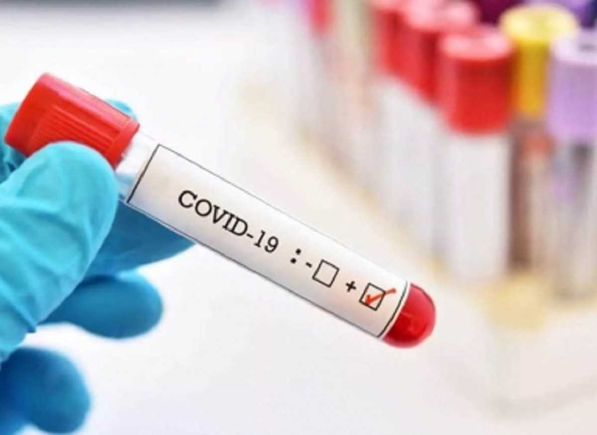 अर्जेंटीना से ताज देखने आया पर्यटक Covid पॉजिटिव, तलाश में जुटी स्वास्थ्य विभाग की टीम