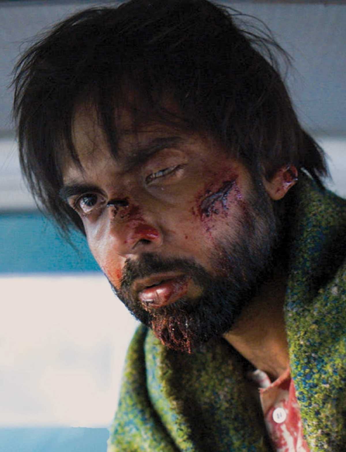 अभिषेक बनर्जी का स्टोलन से फर्स्ट लुक रिलीज, जख्मी दिखे एक्टर