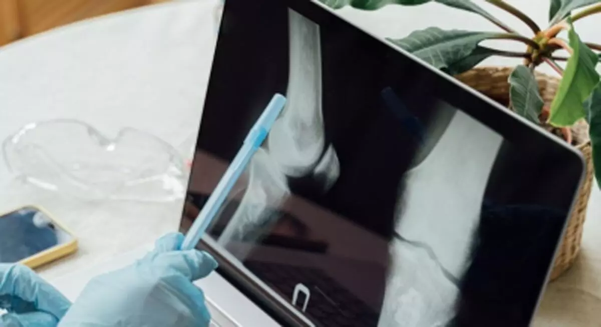 भारतीय वैज्ञानिकों की बड़ी उपलब्धि, शुरुआती हड्डी कैंसर का पता लगाएगा नया उपकरण भारतीय वैज्ञानिकों की बड़ी उपलब्धि, शुरुआती हड्डी कैंसर का पता लगाएगा नया उपकरण