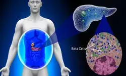 आईआईटी बॉम्बे की रिसर्च में खुलासा, शरीर में मौजूद कॉलेजन प्रोटीन से बढ़ रहा डायबिटीज का खतरा