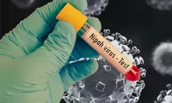 केरल में निपाह वायरस का प्रकोप, निगरानी में 425 लोग केरल में निपाह वायरस का प्रकोप, निगरानी में 425 लोग