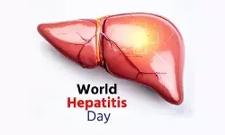 विश्व हेपेटाइटिस दिवस : साइलेंट किलर से सावधान, जागरूकता है उपाय विश्व हेपेटाइटिस दिवस : साइलेंट किलर से सावधान, जागरूकता है उपाय