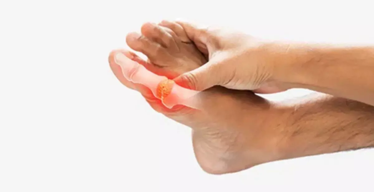 बढ़े यूरिक एसिड से शरीर को कई नुकसान, जीवनशैली में बदलाव है बचाव का उपाय बढ़े यूरिक एसिड से शरीर को कई नुकसान, जीवनशैली में बदलाव है बचाव का उपाय