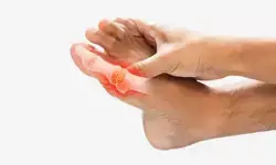 बढ़े यूरिक एसिड से शरीर को कई नुकसान, जीवनशैली में बदलाव है बचाव का उपाय बढ़े यूरिक एसिड से शरीर को कई नुकसान, जीवनशैली में बदलाव है बचाव का उपाय