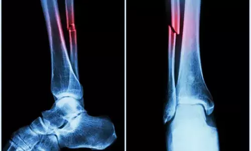 एनआईटी राउरकेला का अध्ययन अस्थि पुनर्जनन तकनीक को बढ़ावा देगा एनआईटी राउरकेला का अध्ययन अस्थि पुनर्जनन तकनीक को बढ़ावा देगा