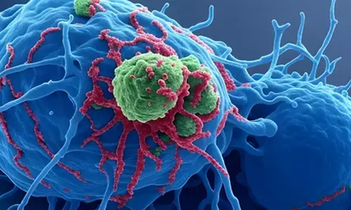 इम्यूनोथेरेपी की नई दवा ने तेजी से बढ़ने वाले कैंसर में दिखाए चौंकाने वाले नतीजे इम्यूनोथेरेपी की नई दवा ने तेजी से बढ़ने वाले कैंसर में दिखाए चौंकाने वाले नतीजे