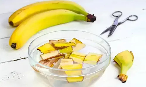 कचरा नहीं है केले का छिलका, वैज्ञानिकों की रिसर्च में सामने आए सेहत से जुड़े कई फायदे