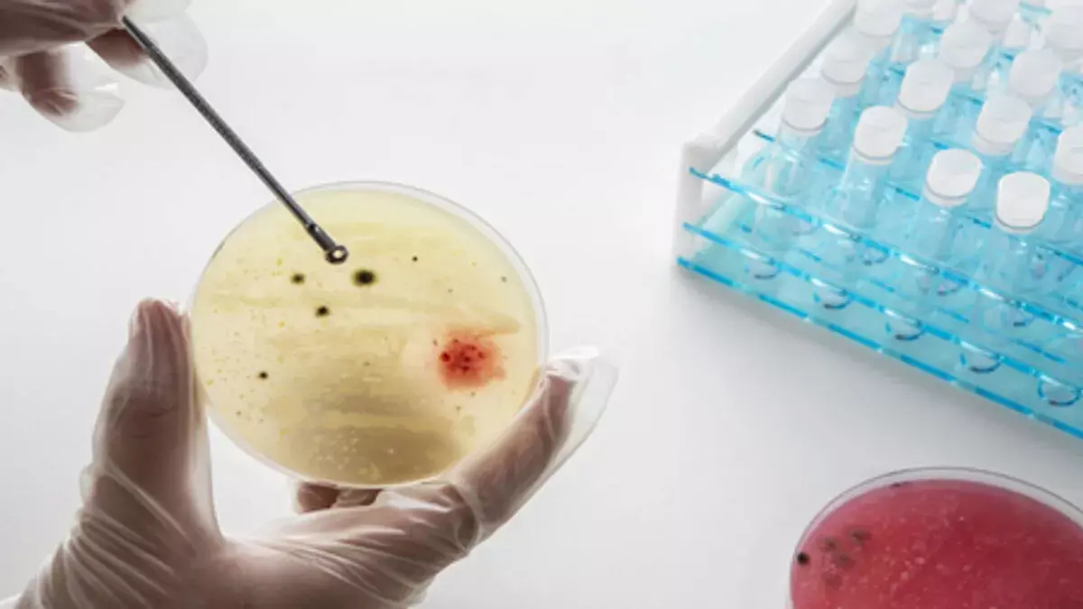 घनी आबादी वाले शहरों में फेफड़े और आंत में संक्रमण का खतरा ज्यादा : स्टडी घनी आबादी वाले शहरों में फेफड़े और आंत में संक्रमण का खतरा ज्यादा : स्टडी