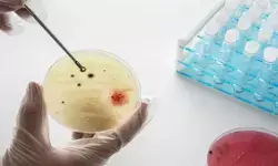 घनी आबादी वाले शहरों में फेफड़े और आंत में संक्रमण का खतरा ज्यादा : स्टडी घनी आबादी वाले शहरों में फेफड़े और आंत में संक्रमण का खतरा ज्यादा : स्टडी