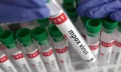 एमपॉक्स अब वैश्विक पब्लिक हेल्थ इमरजेंसी नहीं है : डब्ल्यूएचओ