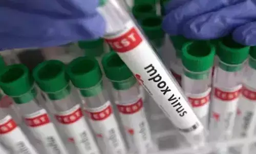 एमपॉक्स अब वैश्विक पब्लिक हेल्थ इमरजेंसी नहीं है : डब्ल्यूएचओ