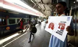 जल्द ही एक साधारण माउथ स्वैब से टीबी की जांच होगी संभव : अध्ययन