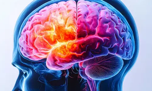 वैस्कुलर डिमेंशिया एक बड़ी समस्या, माइक्रोप्लास्टिक्स से दिमाग को पहुंचा नुकसान : अध्ययन वैस्कुलर डिमेंशिया एक बड़ी समस्या, माइक्रोप्लास्टिक्स से दिमाग को पहुंचा नुकसान : अध्ययन