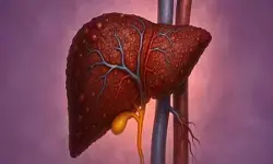 फैटी लिवर चुपचाप शरीर को पहुंचाता है नुकसान! आयुर्वेद से जानें बचाव के उपाय