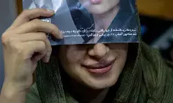 अफगानिस्तान: खूबसूरत दिखने के लिए बोटॉक्स करा रही हैं महिलाएं अफगानिस्तान: खूबसूरत दिखने के लिए बोटॉक्स करा रही हैं महिलाएं