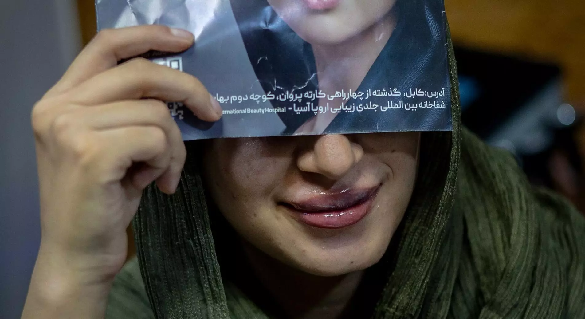 अफगानिस्तान: खूबसूरत दिखने के लिए बोटॉक्स करा रही हैं महिलाएं