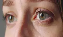 डायबीटिक रेटिनोपैथी का पता तब तक नहीं चलता जब तक दिखना बंद न हो जाए : विशेषज्ञ