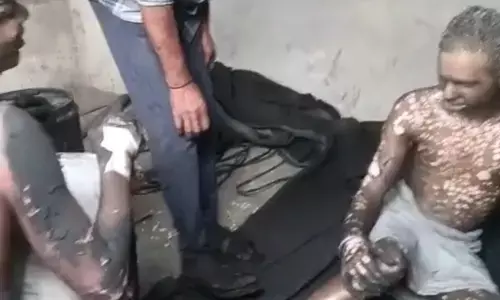 मुरैना फैक्ट्री में गैस पाइप फटने से हादसा, तीन मजदूर गंभीर रूप से झुलसे