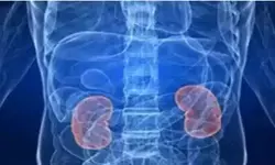 किडनी स्टोन में अचानक बढ़ोतरी! क्या बदल गई है हमारी डाइट?