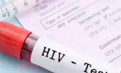 नेपाल : पिछले 15 साल में एचआईवी संक्रमितों की संख्या तेजी से गिरी