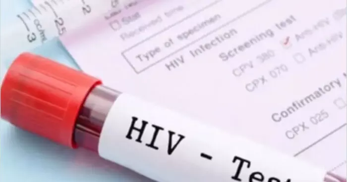 नेपाल : पिछले 15 साल में एचआईवी संक्रमितों की संख्या तेजी से गिरी नेपाल : पिछले 15 साल में एचआईवी संक्रमितों की संख्या तेजी से गिरी