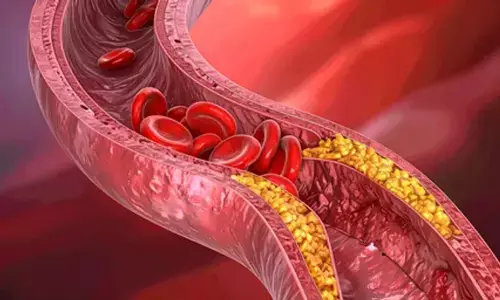 कोलेस्ट्रॉल शरीर के लिए जरूरी, सिर्फ इसकी अधिकता खतरनाक कोलेस्ट्रॉल शरीर के लिए जरूरी, सिर्फ इसकी अधिकता खतरनाक