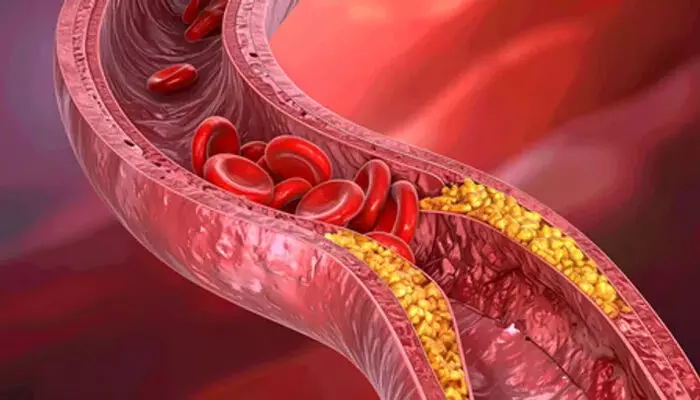 कोलेस्ट्रॉल शरीर के लिए जरूरी, सिर्फ इसकी अधिकता खतरनाक
