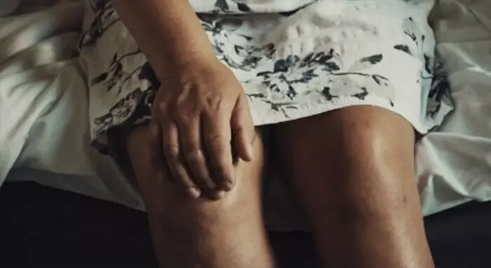 घुटने के चटकने पर आवाज क्यों आती है? कब मानें ये है रेड सिग्नल!