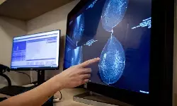 ब्रेस्ट कैंसर के खतरे को पांच साल पहले पकड़ने वाला नया एआई मॉडल ब्रेस्ट कैंसर के खतरे को पांच साल पहले पकड़ने वाला नया एआई मॉडल