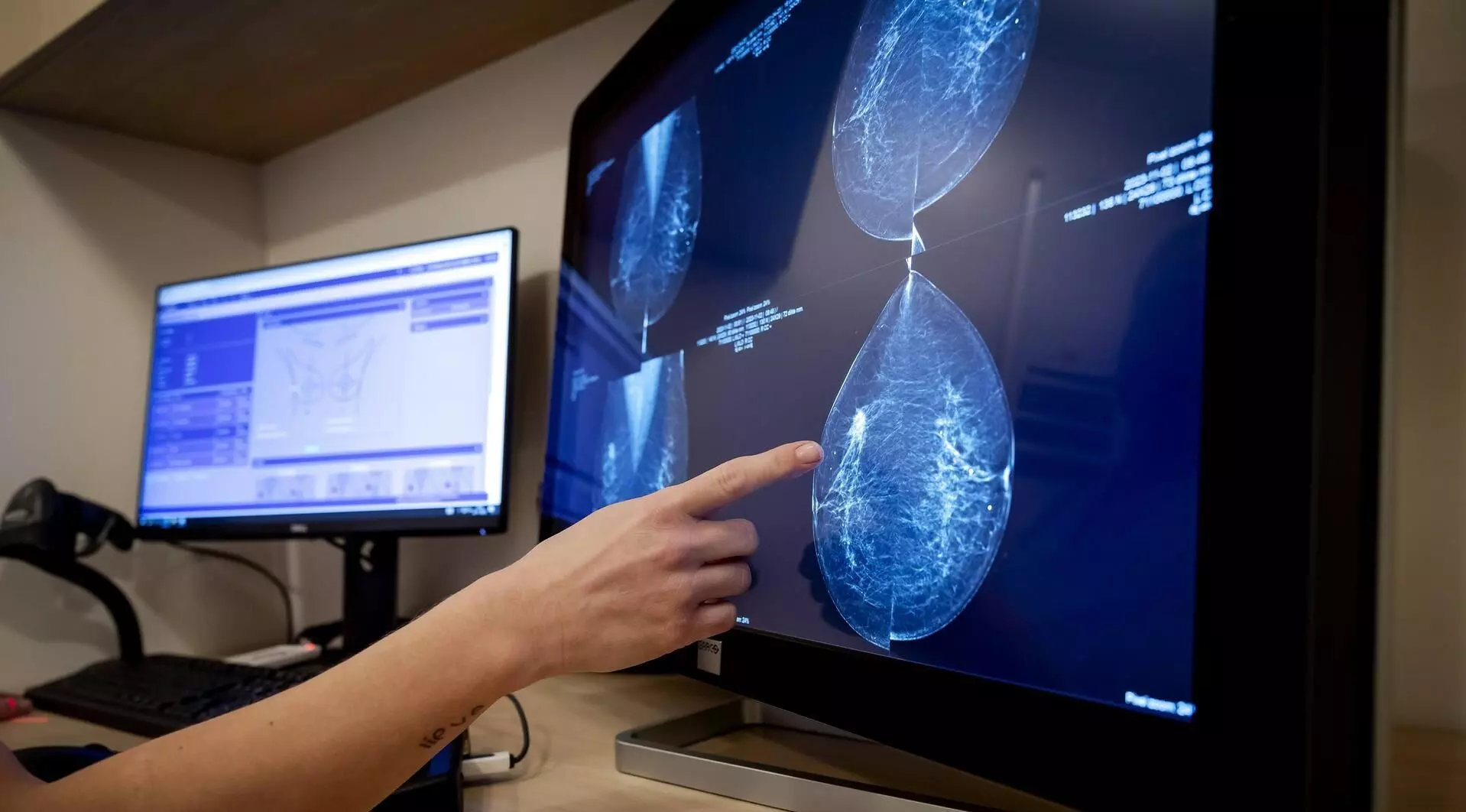 ब्रेस्ट कैंसर के खतरे को पांच साल पहले पकड़ने वाला नया एआई मॉडल ब्रेस्ट कैंसर के खतरे को पांच साल पहले पकड़ने वाला नया एआई मॉडल