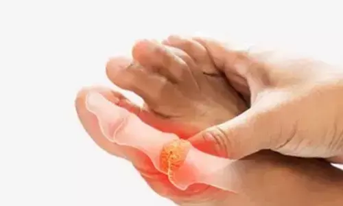 सामान्य नहीं पैर के अंगूठे और जोड़ों में अचानक होने वाला दर्द, आयुर्वेद के पास है समाधान सामान्य नहीं पैर के अंगूठे और जोड़ों में अचानक होने वाला दर्द, आयुर्वेद के पास है समाधान