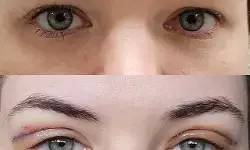 रोशनी का इंतजार लंबा होता जा रहा है जम्मू कश्मीर में क्योंकि आंखों का दान बहुत कम