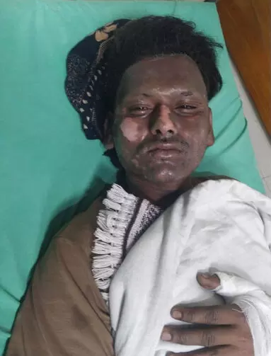 ग्रेटर नोएडा में गैस सिलेंडर फटने से हादसा, चार लोग झुलसे