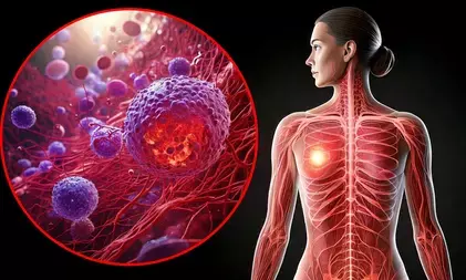 किशोरावस्था में व्यायाम से ब्रेस्ट कैंसर का खतरा कम: नई स्टडी में खुलासा