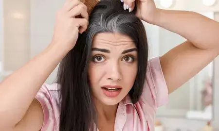 कम उम्र में सफेद हो रहे बाल? जीन, तनाव और खानपान हैं इसके कारण कम उम्र में सफेद हो रहे बाल? जीन, तनाव और खानपान हैं इसके कारण