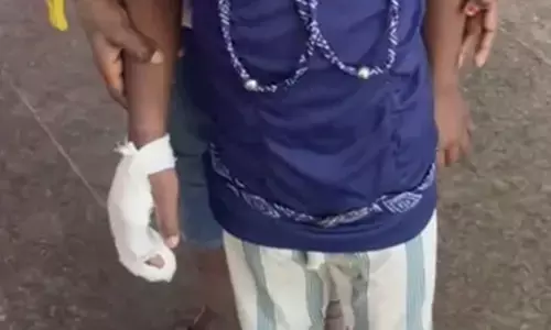 कर्नाटक: स्कूल में छात्रा की उंगली कटने पर बीईओ और शिक्षकों के खिलाफ एफआईआर