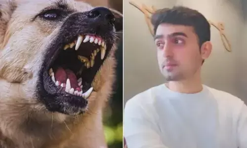 कल्याण में बैंक कर्मचारी की आत्महत्या – रेबीज के डर ने ली जान कल्याण में बैंक कर्मचारी की आत्महत्या – रेबीज के डर ने ली जान