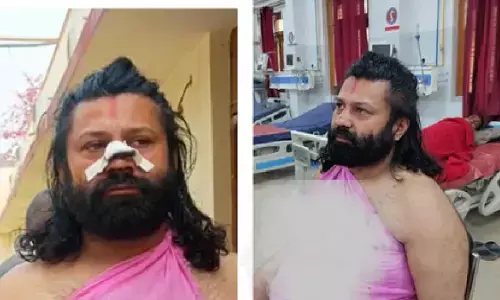 स्वामी अविमुक्तेश्वरानंद के खिलाफ FIR कराने वाले आशुतोष महाराज पर ट्रेन में हमला, नाक काटने का प्रयास