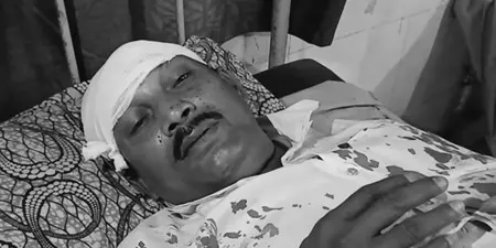 पश्चिम बंगाल चुनाव के दौरान नादिया में हिंसा: टीएमसी के बदमाशों ने मेरे सिर पर रॉड से वार किया ,भाजपा पोलिंग एजेंट पश्चिम बंगाल चुनाव के दौरान नादिया में हिंसा: टीएमसी के बदमाशों ने मेरे सिर पर रॉड से वार किया ,भाजपा पोलिंग एजेंट