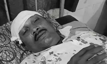 पश्चिम बंगाल चुनाव के दौरान नादिया में हिंसा: टीएमसी के बदमाशों ने मेरे सिर पर रॉड से वार किया ,भाजपा पोलिंग एजेंट