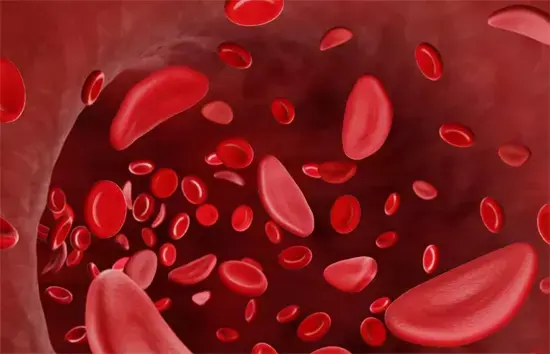 सिकल सेल रोग: विश्व सिकल दिवस, सिकल सेल : समानता का हकदार सिकल सेल रोग: विश्व सिकल दिवस, सिकल सेल : समानता का हकदार
