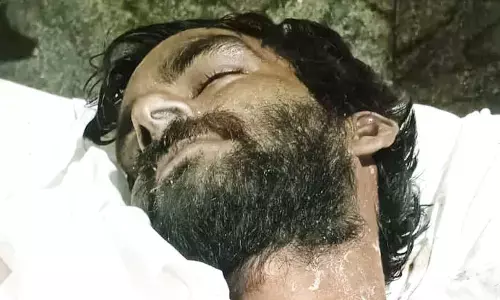 मेनहोल में तारों में फंसा शिवा, अस्पताल में तोड़ा दम; ठेकेदार पर FIR और ब्लैकलिस्ट की कार्रवाई